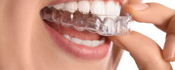 traitement du bruxisme